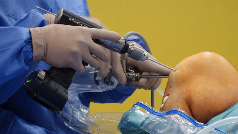 Orthopaedics & Joint Replacement